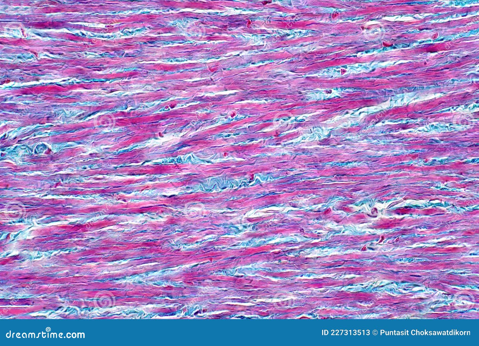 Areolar Connective Tissue Under The Light Microscope View Human