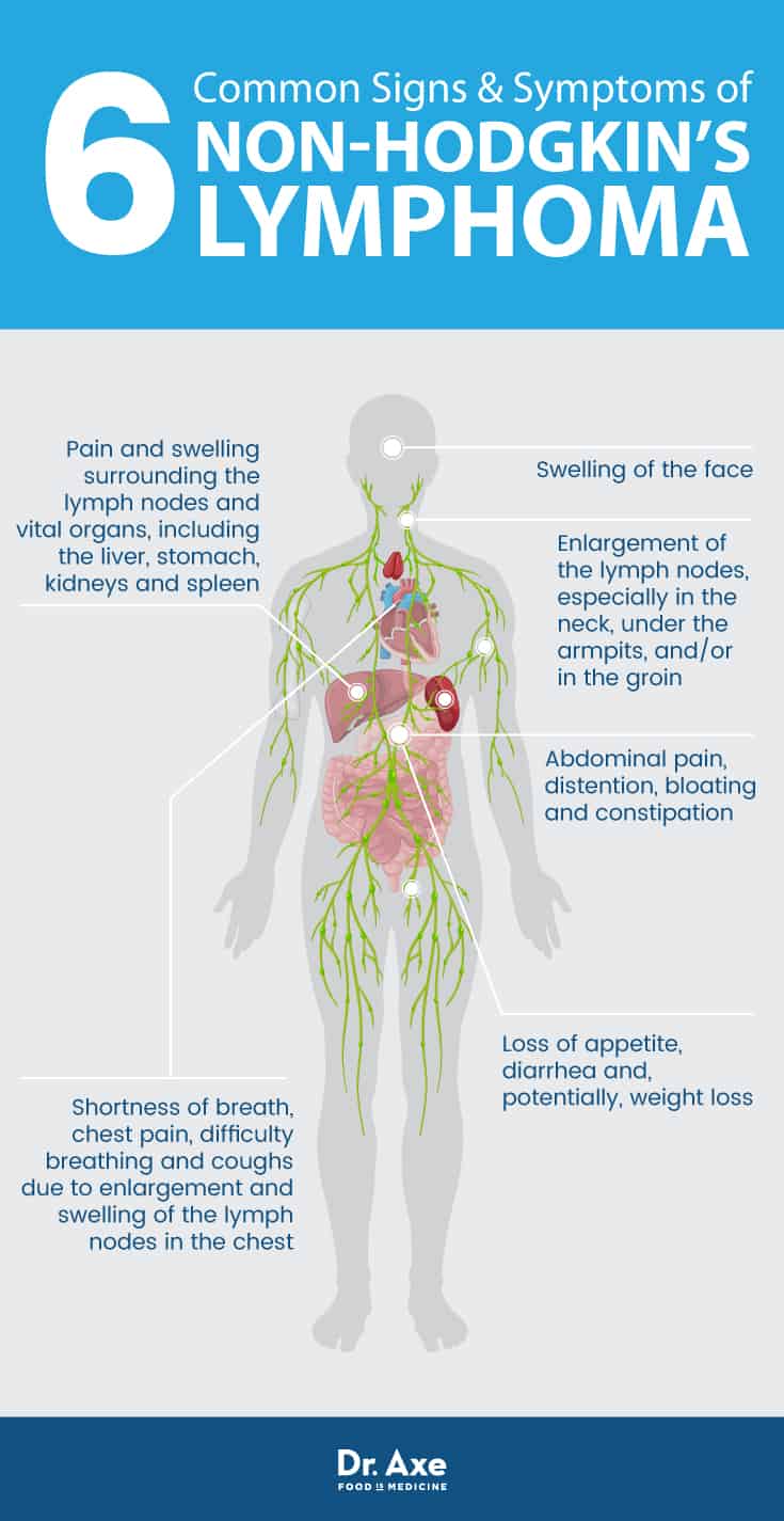 Diagram Difference Between Hodgkin And Non Hodgkin Lymphoma