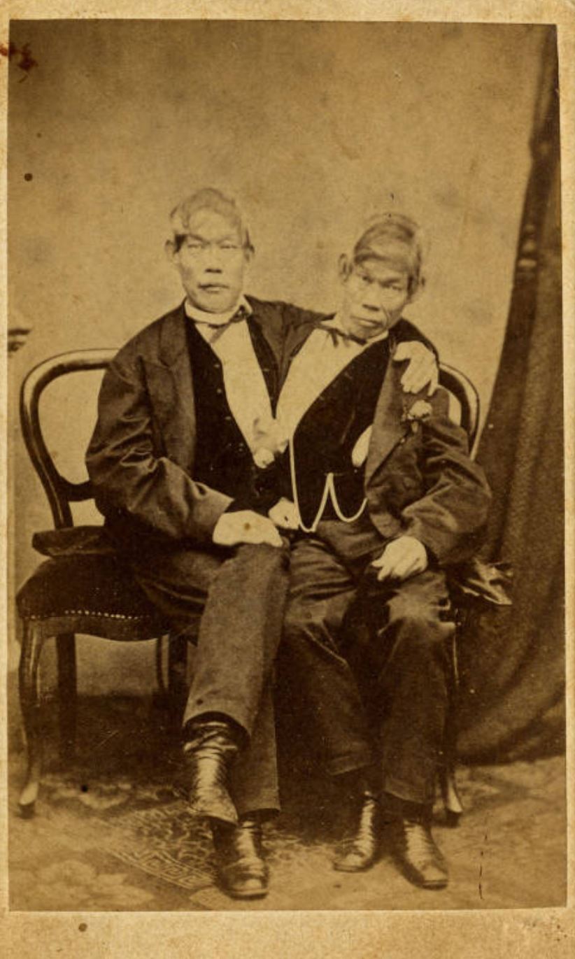 Eng And Chang Bunker The Siamese Twins Unc University Libraries