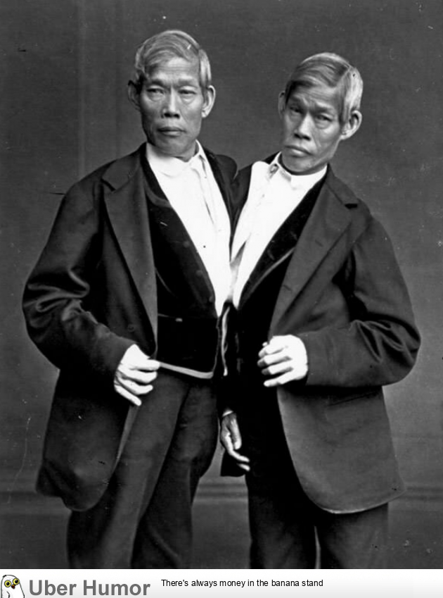 The World S Most Famous Conjoined Twins Chang And Eng Bunker 1811